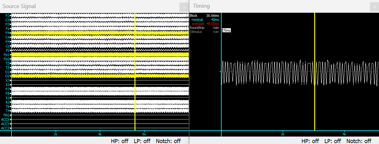../../_images/bci2000-3.png